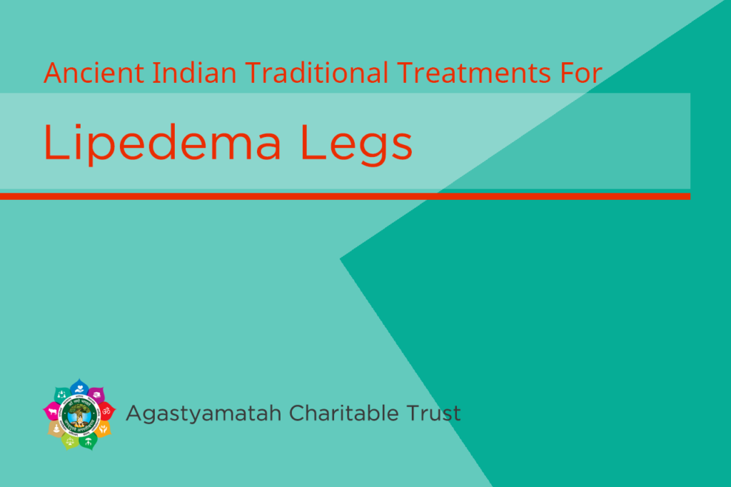 Treatments Lipedema Legs India -AMCT | NadiSutra.org
